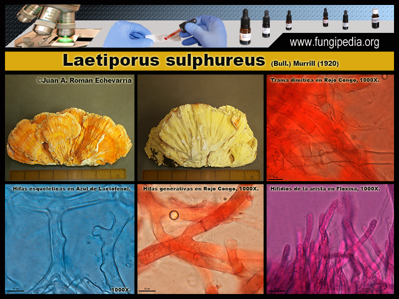 Laetiporus_sulphureus_Microscopia_Microscopy1.jpg