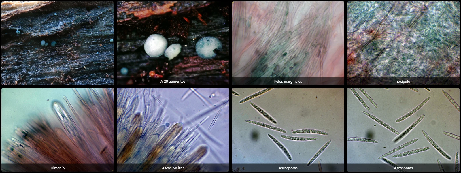 Aeruginoscyphus sericeus