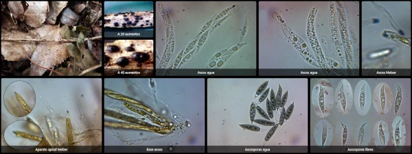Alloanthostomella rubicola