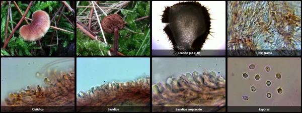 Microscopía de Auriscalpium vulgare