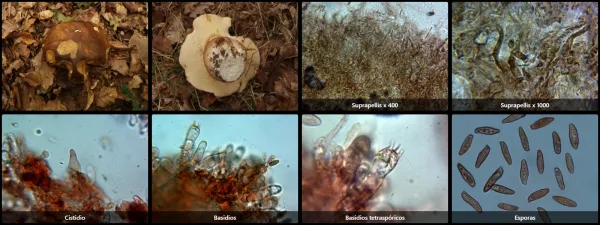 Microscopía de Boletus aereus