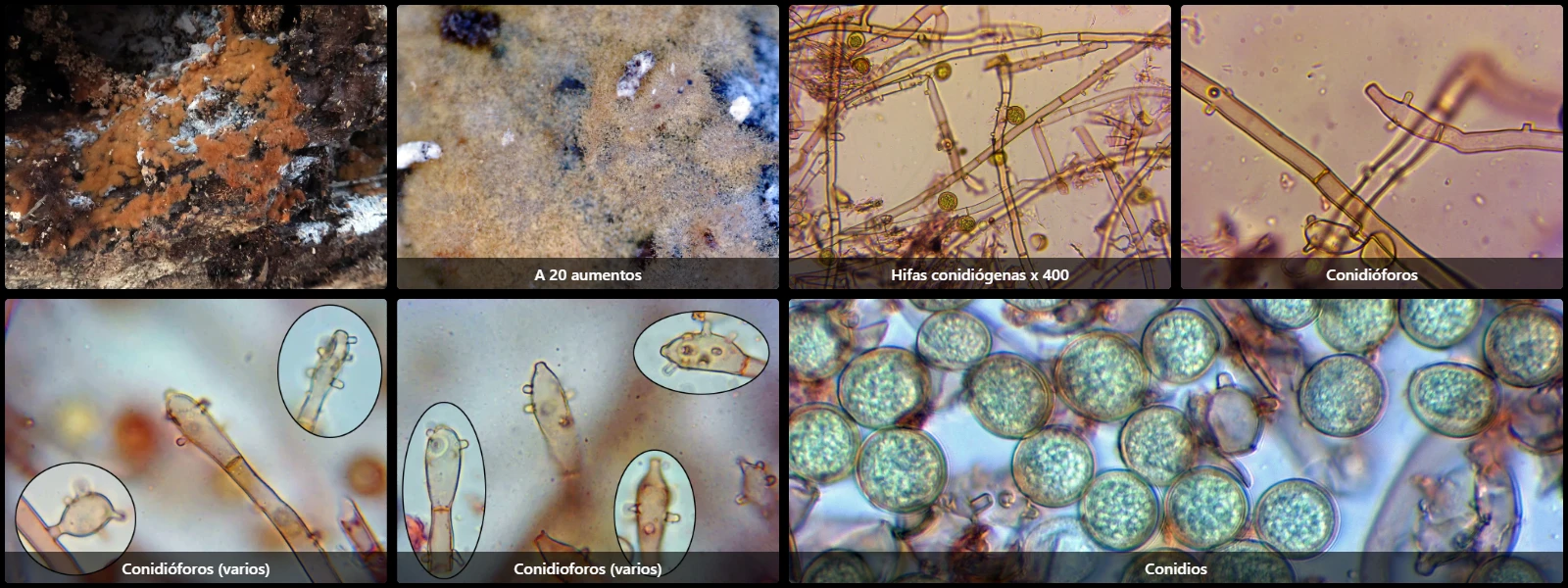 Botryobasidium robustius