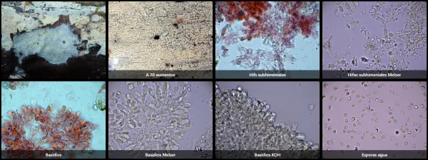Brevicellicium olivascens