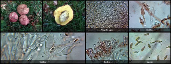 Microscopía de Butyriboletus regius