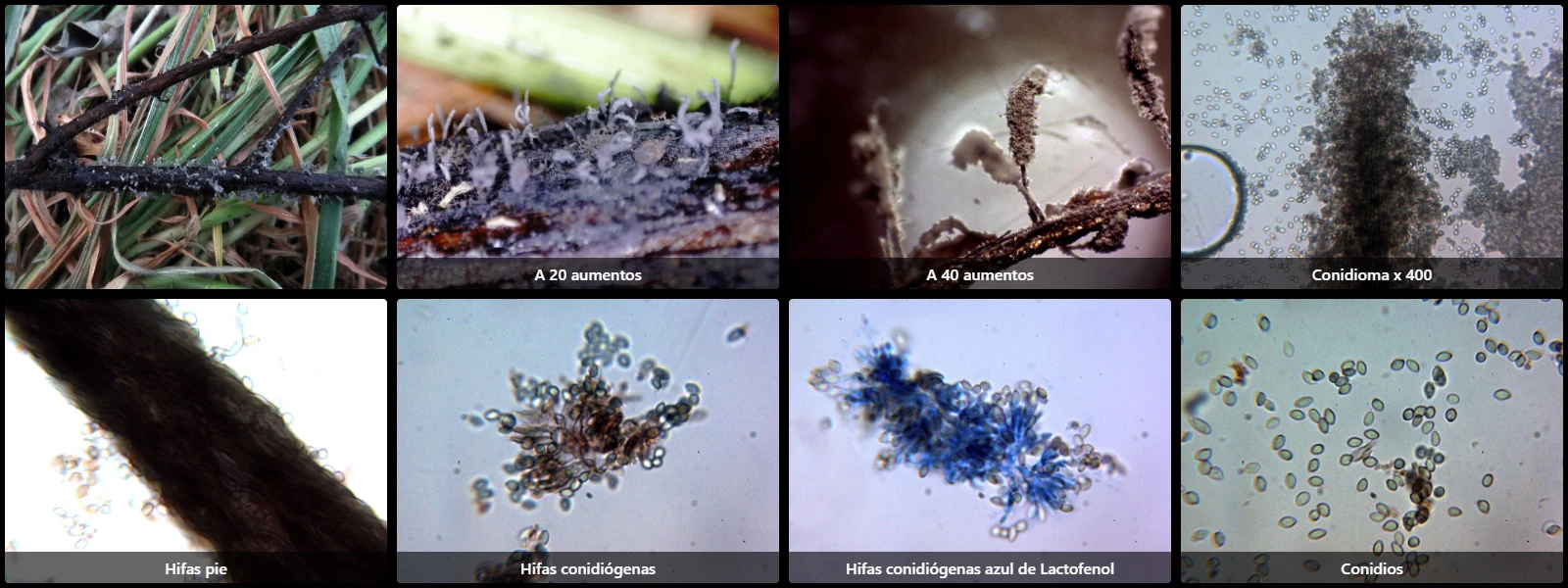 Cephalotrichum microsporum