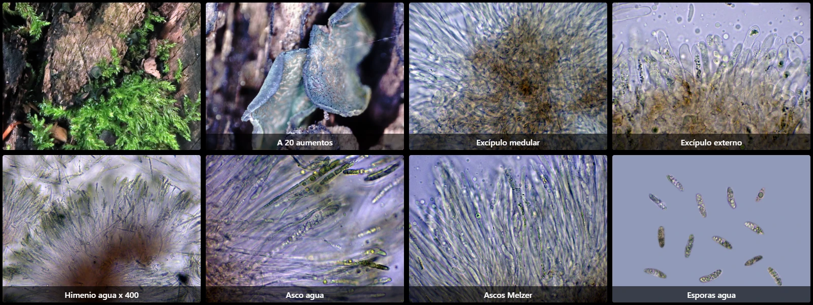 Chlorencoelia versiformis